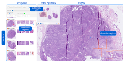 Teaser image for paper Rapid Assisted Visual Search: Supporting digital pathologists with imperfect AI